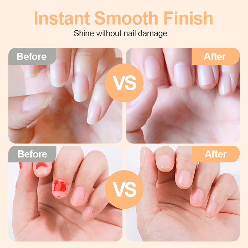 🎉 Promotions 2026 — Plus de 113 000 exemplaires vendus ! ✂️ Coupe-ongles et polisseur électrique intelligent 2-en-1 – Système de sécurité anti-pincement et éclairage LED 💅